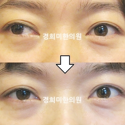 이미지03