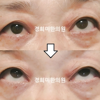 이미지04