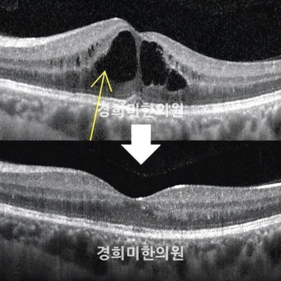 이미지05